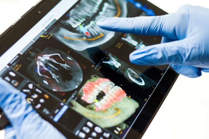 AI Revolution: Pioneering Caries Detection and Practice Efficiency