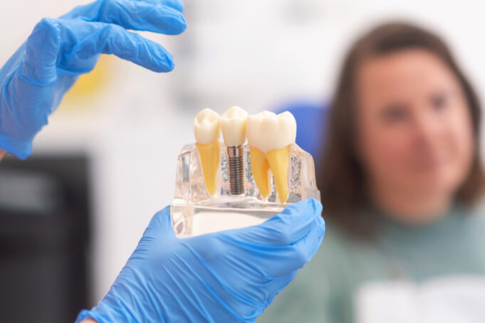 The Latest in Implant Dentistry: Key Takeaways from the Implant Solutions World Summit 2024