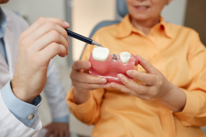 Dental Implant Failures: Why They Happen and How to Stay Ahead of Them